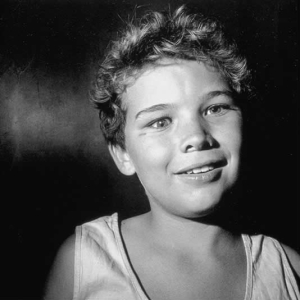 Teenager with glass eye, Western Transvaal, 1994